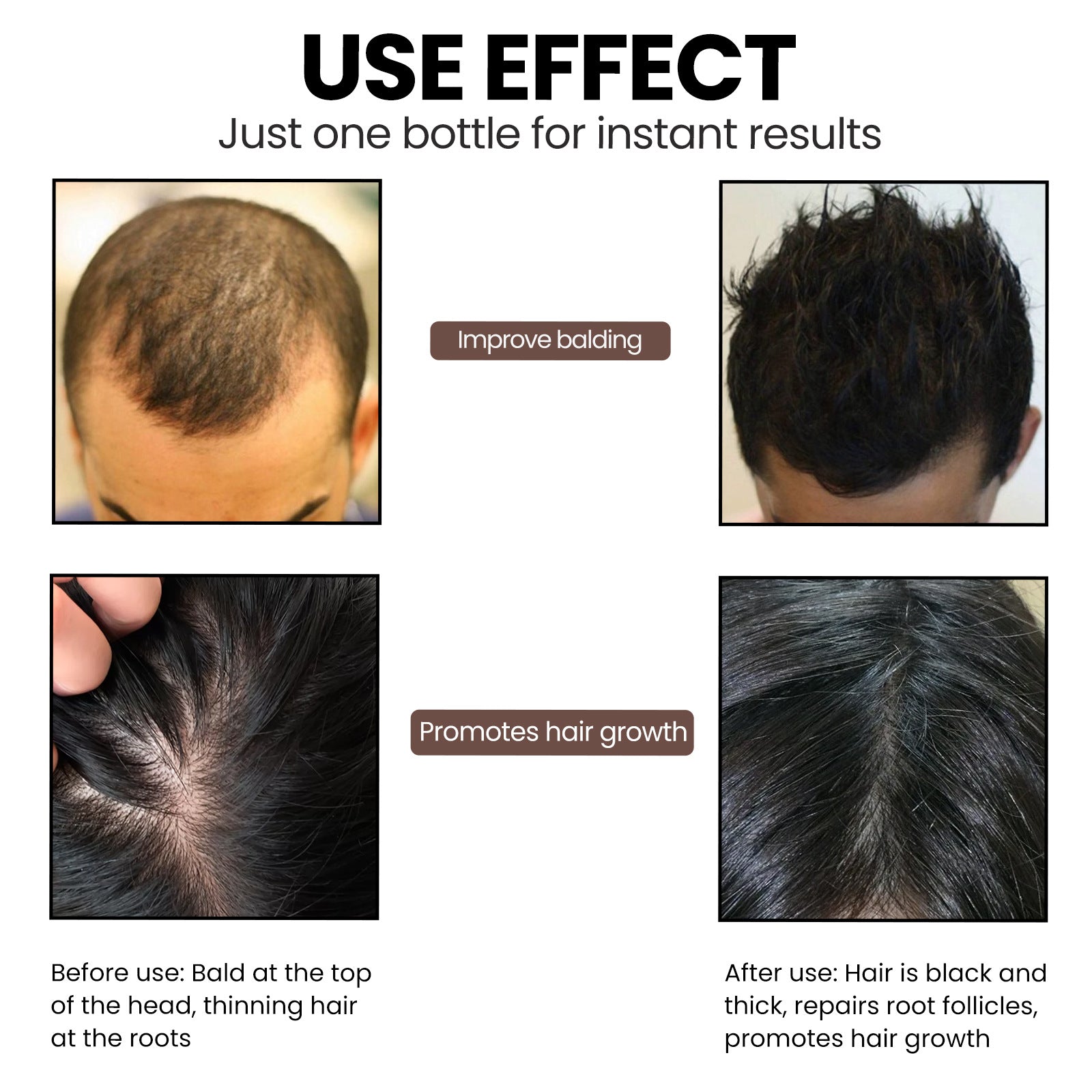 EELHOE Hair Strengthening Essence for Nourished Roots