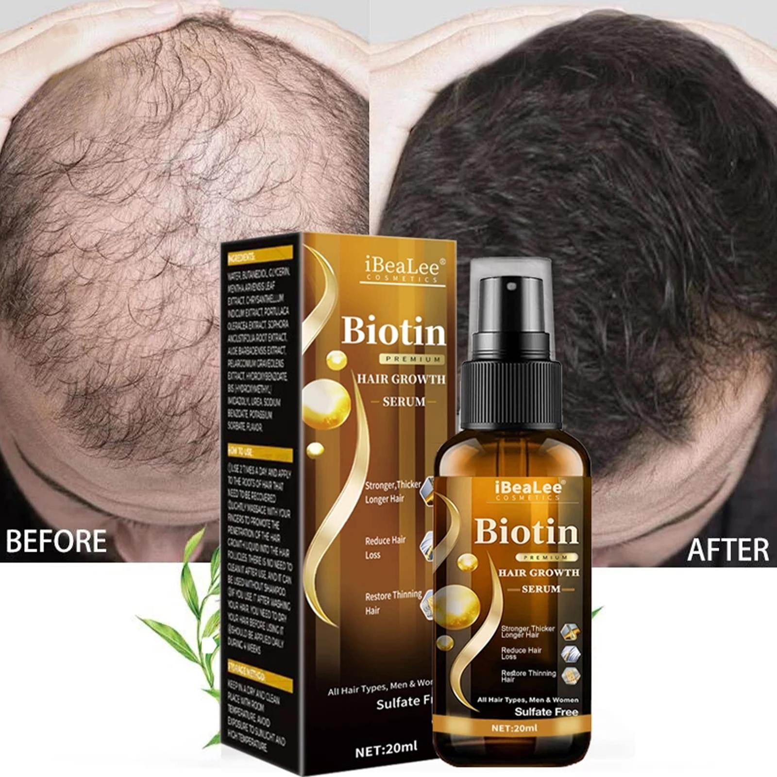 iBraLee Anti-Hair Loss Growth Liquid Hair Essence